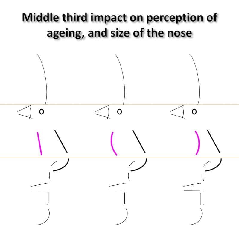 Impact de la projection de le joue sur la perception de la taille du nez